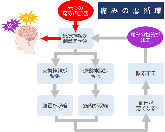 痛みの悪循環